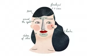 Temukan Peta Jerawat Di Wajah Apa Penyebabnya.